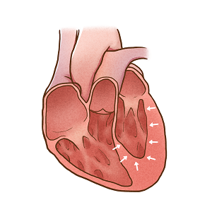 1654534011512985.png 攝圖網_401796677_舒張性心力衰竭(企業商用).png