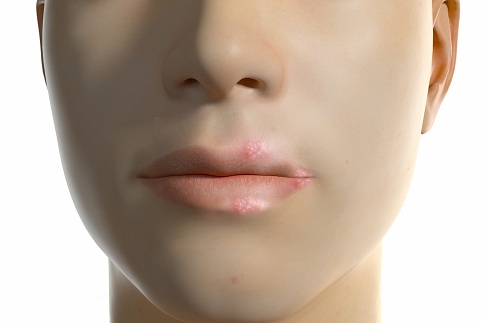 1654789066797713.jpg 攝圖網_402025796_banner_三維口唇皰疹場景(企業商用).jpg