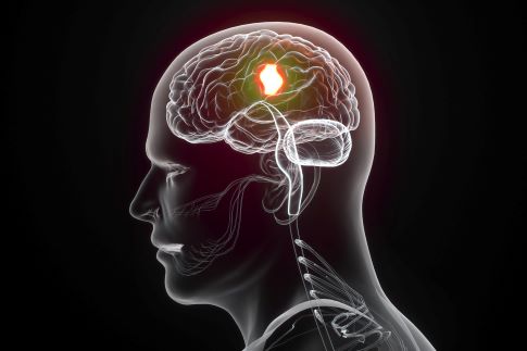 1714613526772148.jpg 攝圖網_401859899_C4D腦癌病變場景(企業商用).jpg