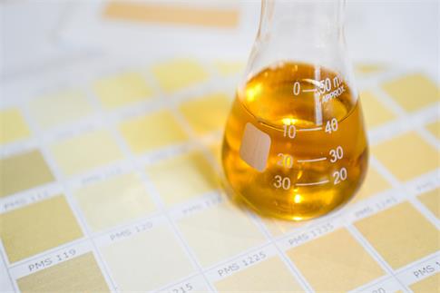 1727570421370451.jpg 攝圖網(wǎng)_329792623_含有尿液的酒瓶 醫(yī)學(xué)分析概念 根據(jù)尿質(zhì)顏色進(jìn)行診斷液體考試圖表指標(biāo)實(shí)驗(yàn)室化學(xué)品塑料化學(xué)生物學(xué)疾病(非企業(yè)商用).jpg