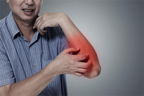 1735172412592616.jpg 攝圖網_401870392_皮膚紅腫(企業商用).jpg