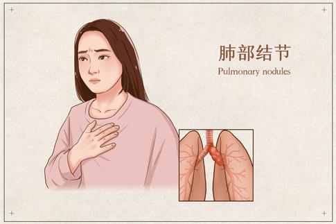 1738973377843258.jpg 攝圖網(wǎng)_401863170_banner_肺部結節(jié)醫(yī)療插畫(企業(yè)商用).jpg